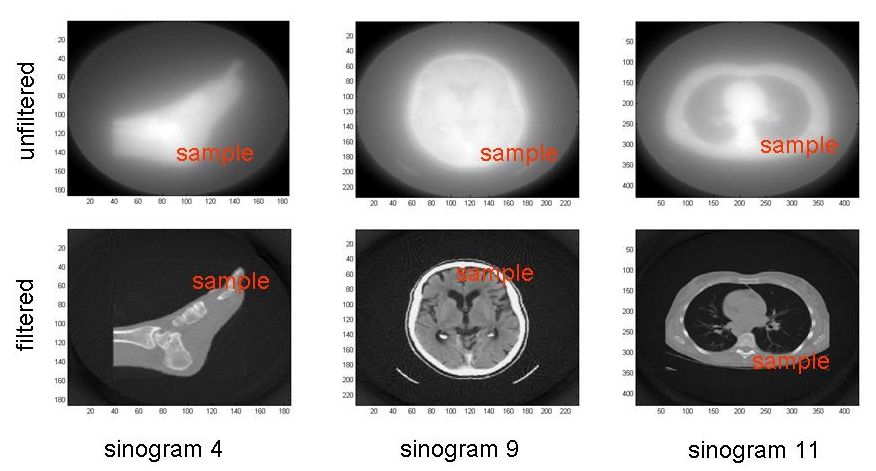 CSE 594 - Medical Imaging